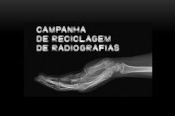 AMI recolhe radiografias para as transformar em angariação de fundos