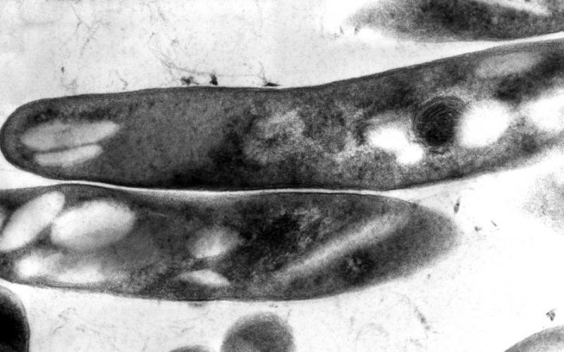 Saúde | Portugal regista 1.700 casos de Tuberculose, mas ainda morrem 1,5 milhões de pessoas em todo o mundo