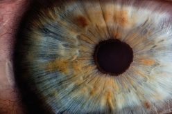 Estar atento aos sintomas das doenças raras oculares
