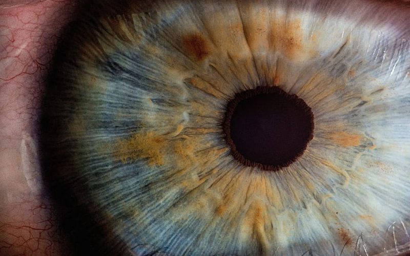 Estar atento aos sintomas das doenças raras oculares