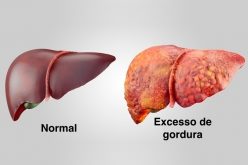 Uma epidemia de maus fígados devida à má-nutrição